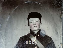 Quarter Plate Tinted Tintype Civil War Young Freckled Face Soldier Half Case